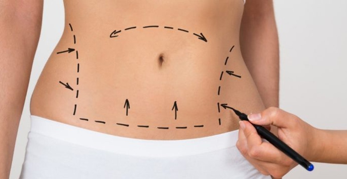 ¿Cuáles son los tratamientos más populares en medicina estética?